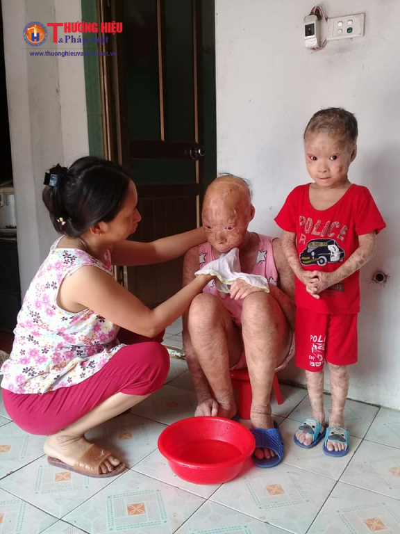 Chị Đào đang chăm sóc vệ sinh cá nhân cho hai đứa con bệnh tật của mình.