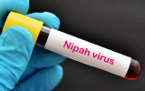 Bộ Y tế yêu cầu cách ly nghiêm ngặt các trường hợp nghi ngờ mắc virus Nipah