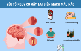 Nguyên nhân tai biến mạch máu não: 6 yếu tố nguy cơ nhiều người đang bỏ qua