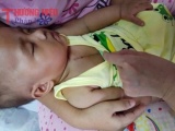 Nhói lòng cảnh bé gái 8 tháng tuổi mắc bệnh tim phải ăn bữa đói bữa no qua ngày