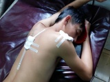Đắk Lắk: Làm rõ vụ công an xã bắn 3 thanh niên nẹt pô xe máy
