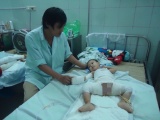 Đáng thương bé trai 14 tháng tuổi bỏng nặng do ngã vào nồi chè nóng