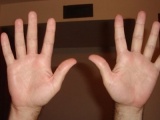 Lý giải nguyên nhân con người có 10 ngón tay