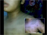 Vĩnh Long: Bé trai 9 tuổi bị mẹ và dì bạo hành phải nhập viện