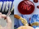 50.000 người có thể nhiễm HIV mà không biết