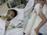 Rơi nước mắt hoàn cảnh bé gái 11 tuổi bị xe tải cán, không có tiền phẫu thuật