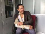 Bệnh nhân đầu tiên được thay đài quay tay nhân tạo ở Việt Nam