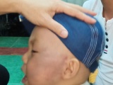 Vĩnh Long: Bảo mẫu đánh bé trai 19 tháng tuổi phải nhập viện