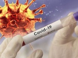 Mỹ bắt đầu thử nghiệm vaccine chống virus corona từ hôm nay