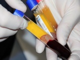 Việt Nam nghiên cứu sử dụng huyết tương để điều trị Covid-19