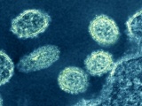 Phát hiện chủng cúm lợn mới có nguồn gốc từ chủng virus H1N1 
