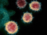 Phát hiện 99 thể đột biến của virus gây dịch bệnh Covid-19