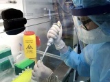 Việt Nam bắt đầu điều trị bệnh nhân Covid-19 bằng huyết tương