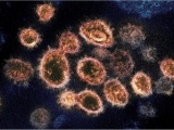 Thêm 1 biến thể virus SARS-CoV-2 được phát hiện ở Nigeria