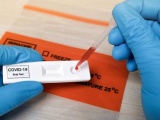 Bộ Y tế yêu cầu kiểm tra việc kinh doanh test kit xét nghiệm nhanh và PCR
