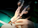 Tay dao hàn mạch Ligasure thế hệ mới: Thiết bị hiện đại giúp tối ưu hóa hiệu quả phẫu thuật 