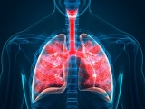 Phát hiện hạt vi nhựa ở sâu trong phổi của người sống