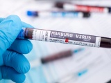 Bộ Y tế yêu cầu tăng cường giám sát phòng chống dịch bệnh Marburg