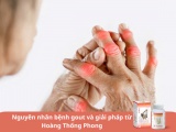 Nguyên nhân bệnh gout và giải pháp từ Hoàng Thống Phong