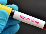 Bộ Y tế yêu cầu cách ly nghiêm ngặt các trường hợp nghi ngờ mắc virus Nipah