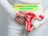 U xơ tử cung có nguy hiểm không? Điều trị như thế nào?