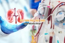 Suy thận phải chạy thận - những điều bạn cần biết