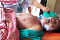 Hà Tĩnh: Cấp cứu kịp thời bệnh nhân người Lào bị ngừng hô hấp