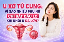 U xơ tử cung: Vì sao nhiều phụ nữ chỉ bắt đầu lo khi khối u đã lớn?