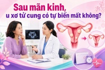 Sau mãn kinh, u xơ tử cung có tự biến mất không? 
