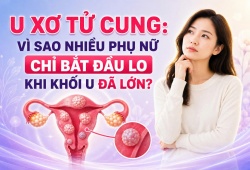 U xơ tử cung: Vì sao nhiều phụ nữ chỉ bắt đầu lo khi khối u đã lớn?