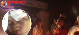 Thanh Thủy – Phú Thọ: Xuất hiện nhóm côn đồ hành hung người dân