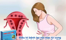 Điều trị bệnh lạc nội mạc tử cung và giải pháp từ Phụ Lạc Cao EX