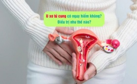 U xơ tử cung có nguy hiểm không? Điều trị như thế nào?