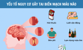 Nguyên nhân tai biến mạch máu não: 6 yếu tố nguy cơ nhiều người đang bỏ qua