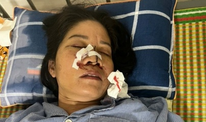 Vụ đối tượng tấn công một phụ nữ đơn thân ở Bắc Giang: Cần làm rõ nguyên nhân