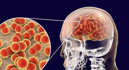Những điều cần biết về bệnh do não mô cầu, người dân cần chủ động phòng tránh 