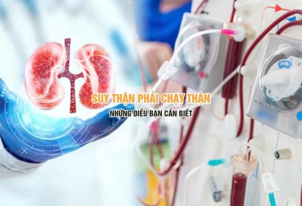 Suy thận phải chạy thận - những điều bạn cần biết