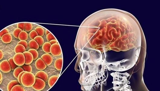 Những điều cần biết về bệnh do não mô cầu, người dân cần chủ động phòng tránh 